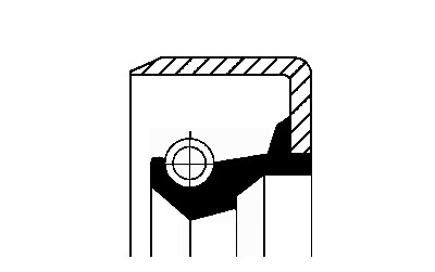Bague d'étanchéité, différentiel
