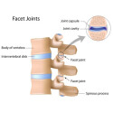 Durite de frein Cautex/Facet 10007